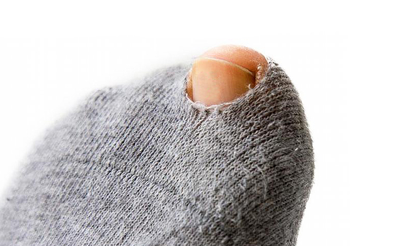 Agujero en el calcetín o “tomate” ¿por qué se rompe siempre por la zona del  dedo gordo o talón? - Podoactiva. Líderes en Podología
